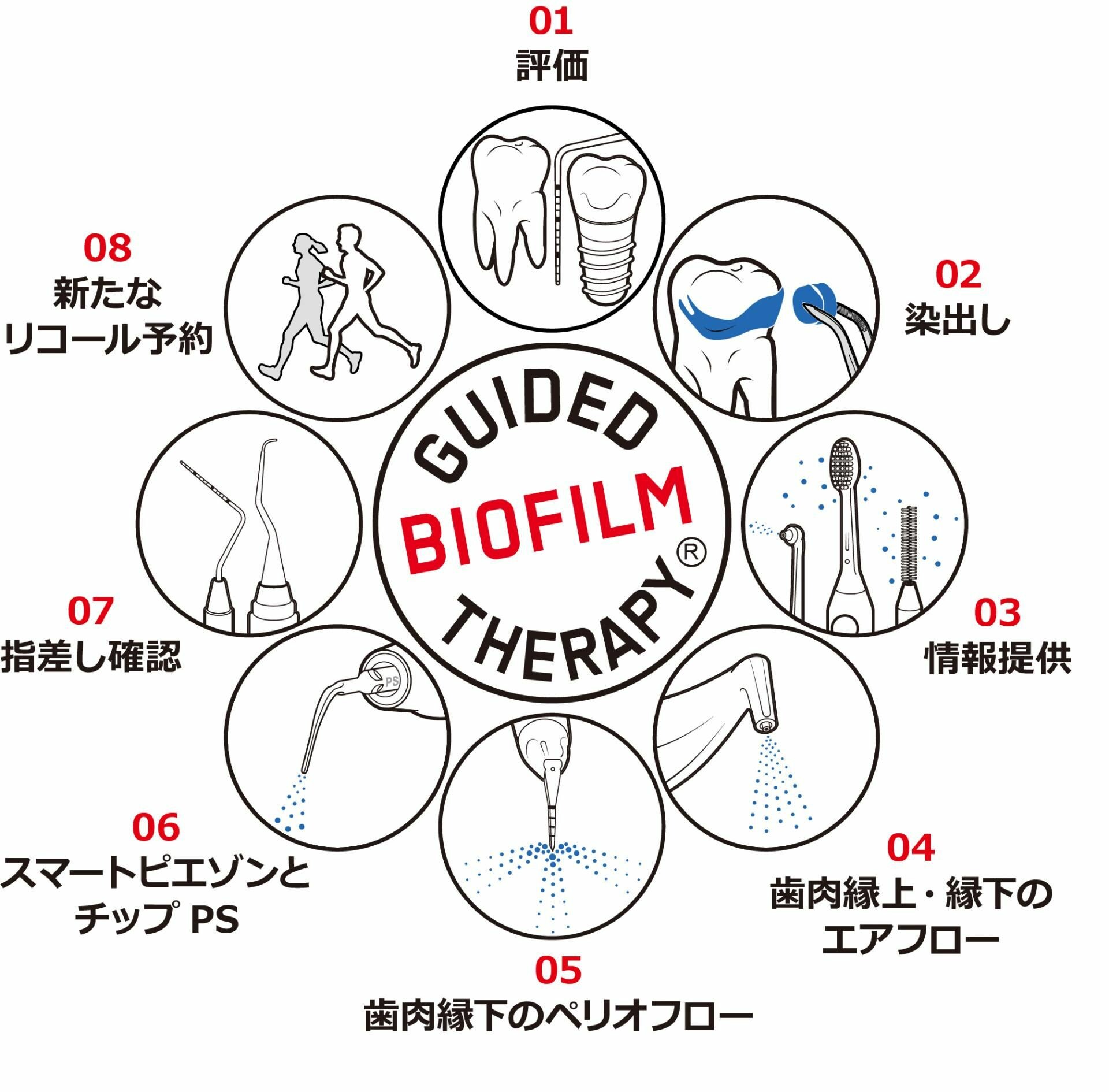 エアフロープロフィラキシスマスター