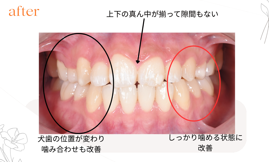 矯正治療